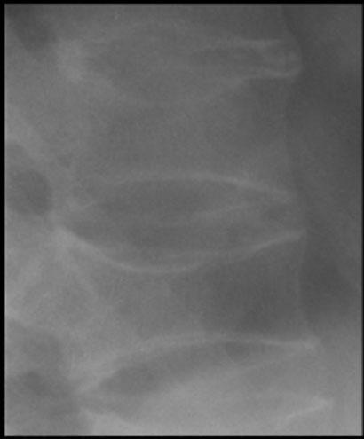 Simple radiographs of