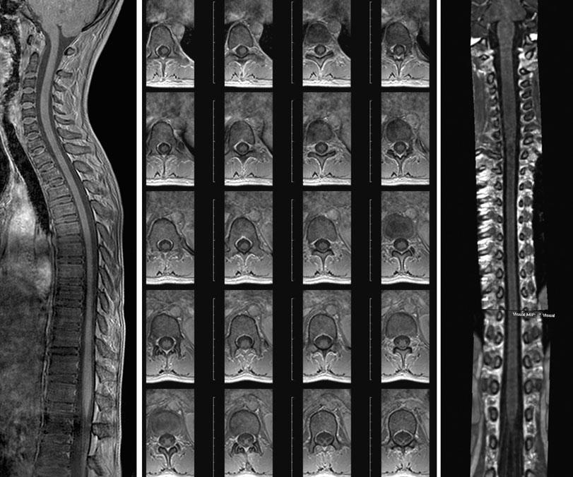 Goo HW C Figure 7. Three-dimensional spine magnetic resonance images (repetition time msec/echo time msec, 7.0/4.6; flip angle, 10 ) at 3 tesla.