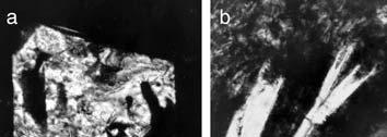 Repeated sharp reversals attributed to magma mixing, followed by normal cooling increments.