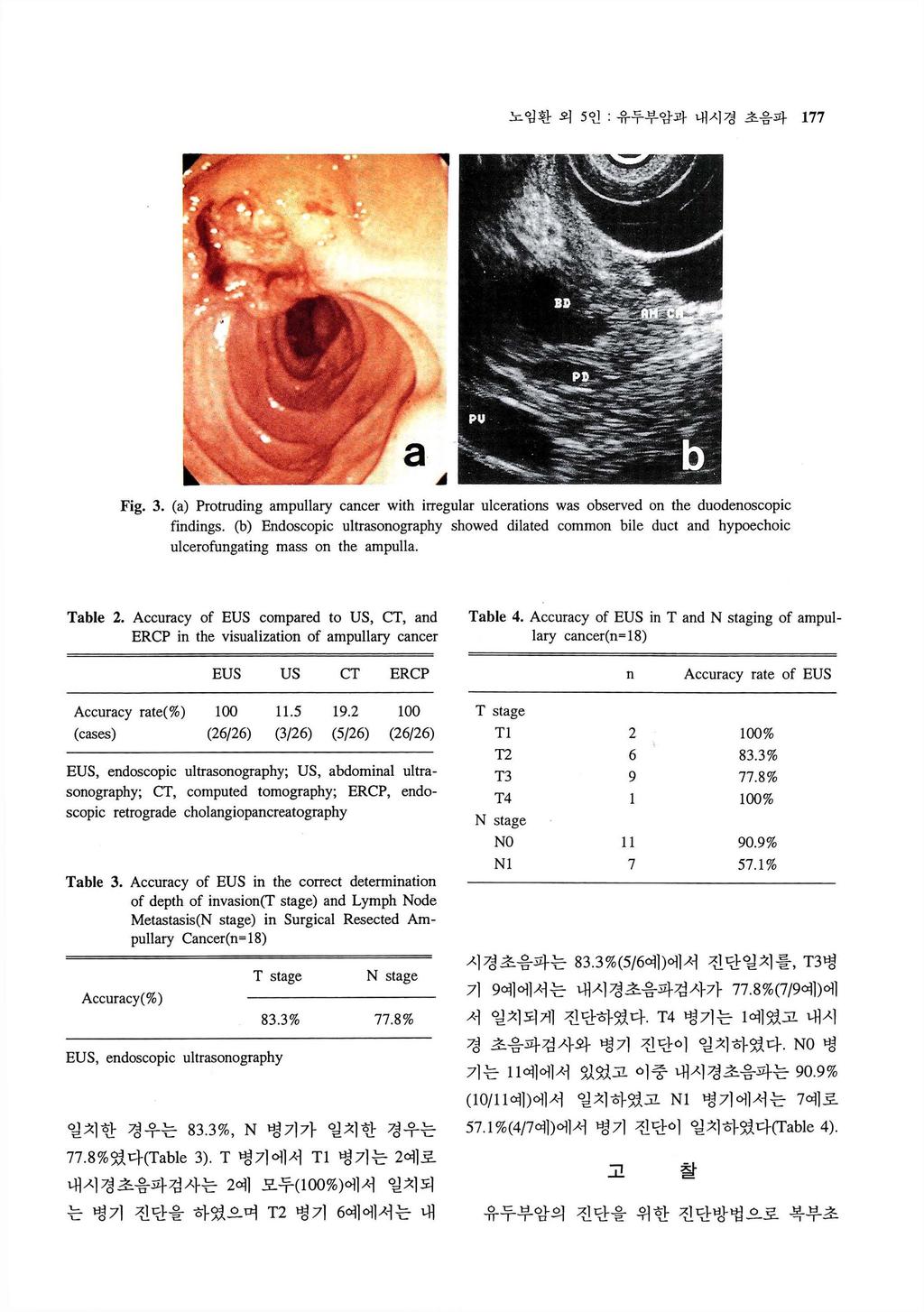 노임환외 5 인, 유두부암과내시경초음파 177 Fig. 3. (a) Protruding ampullary cancer with iπeg비 ar ulcerations was observed on the duodenoscopic findings.