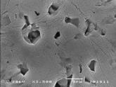 Microstructures of