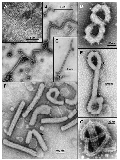 필로바이러스의전자현미경상모습 ( 위 ) 과유전적구조 ( 아래 ) 주 : (A) MARV, (B) EBOV-S, (C) MARV (arrow indicates a branch point in filamentous particle), (D) EBOV-Z, (E) EBOV-Z (arrow indicates glycoprotein peplomers on