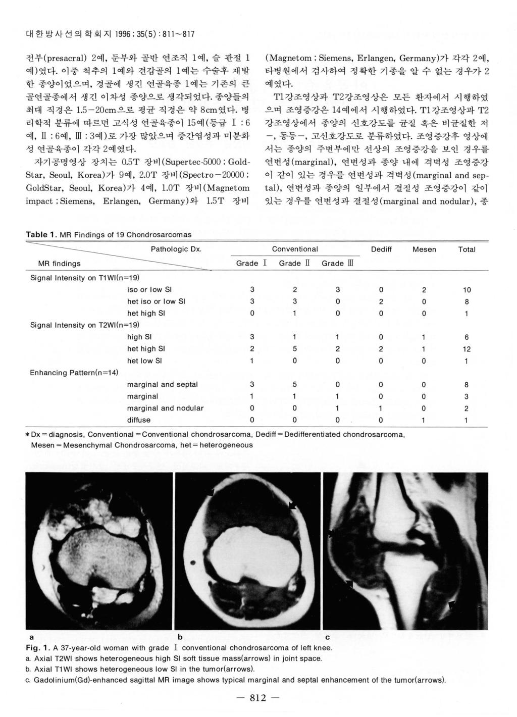 대한방사선의학회지 1996 ; 35( 5) : 8 11-817 전부 (p resacra I) 2 예, 둔부와골반연조직 1 예, 슬관절 l 예 ) 였다. 이중척추의 1 예와견갑골의 1 예는수술후재발한종양이었으며, 경골에생긴연골육종 l 예는기존의큰골연골종에서생긴이차성종양으로생각되었다. 종양들의최대직경은 1. 5-20cm으로평균직경은약 8cm 였다.