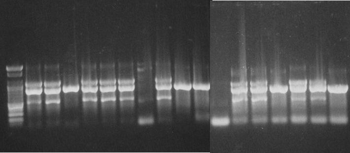 Fig. 2. Electrophoresis of the amplified products of TEM, SHV, CTX genes by a mutiplex PCR in a 2% agarose gel.