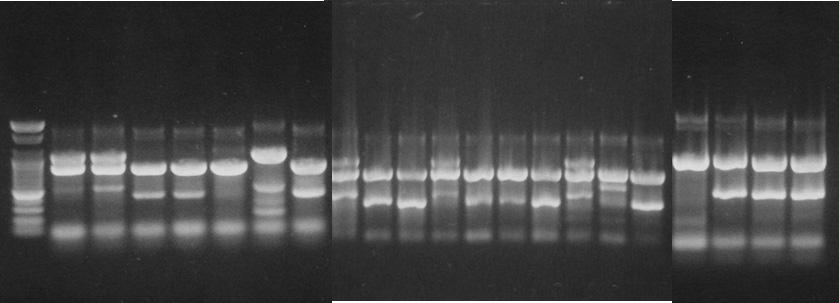 M 1 2 3 4 5 6 7 8 9 10 11 12 13 14 15 16 17 TEM(1080bp) SHV(87bp) CTX(543bp) Fig. 4. Electrophoresis of the amplified products of TEM, SHV, CTX genes by a mutiplex PCR in a 2% agarose gel.