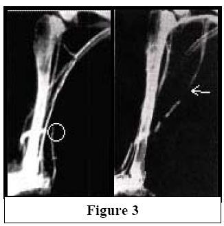 Nattokinase has been the subject of 17 studies, including two small human trials. Dr.