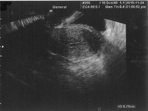 환자명 김 은 경향을 보였으며, 배란 즈음에도 자궁 2. 나이/성별 38/F 3. 초 진 2015년 10월 3일 4.