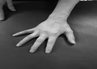 (7) Facilitate palm, thenar portion and hypothenar portion by a physical therapist