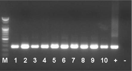 Photomicrograph of white spots on the carapace of white spot syndrome virus (WSSV) infected shrimp (X 100).