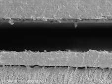 SEM micrograph showing wide gap (G), about 70 μm wide, between the composite resin