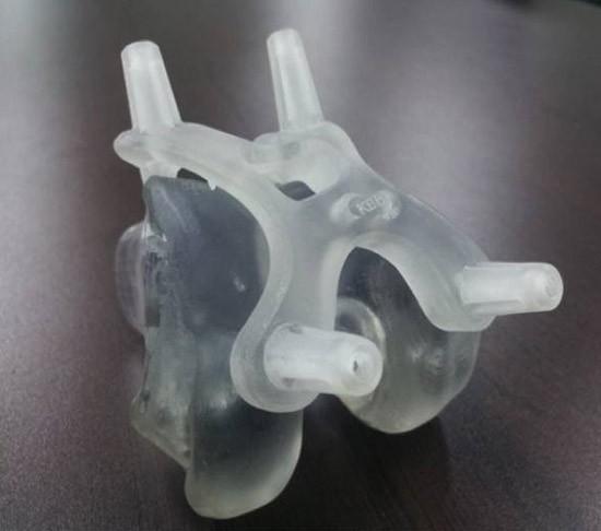 p mletter 국내의료기기제조업체인메디쎄이가신촌세브란스병원신경외과와손잡고 3D 프린터를이용, 환자맞춤형인공머리뼈이식수술에성공 인공뼈의소재변경 : 석고 티타늄 수술시간감소 : 3 시간 1 시간 수술부위의합병증, 감염감소