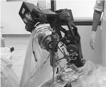 그림 3-8 척추융합수술로봇 (a) 척추융합수술지원수술계획시스템 (Hexaview) (b) 가이드수술로봇 SpineAssist (c) 수술보조로봇 (Hand On