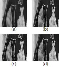 62 Bilateral Filter 를이용한적응적언샤프마스킹김학구외 참고문헌 그림 11. (a) 원본영상, (b) [8], (c) [9], (d) 제안한방법. Fig. 11. (a) Original, (b) [8], (c) [9], (d) Proposed. 고려하여선명도의크기를조절하여개선하였기때문에마찬가지로선명도개선과함께결함이눈에덜띄는결과를보여준다.