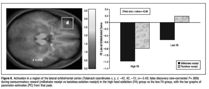 Neural correlates of food addiction. Archives of general psychiatry,68(8), 808-816.