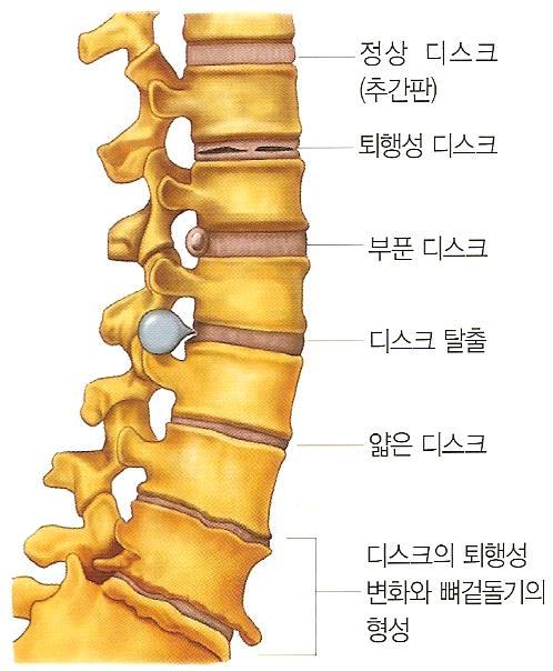 5. 신체부위별골절처치 (2) 척추 - 유연성이있는단단한기둥이며머리와몸체를지탱.