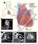 dual-mode MRI 조영제,