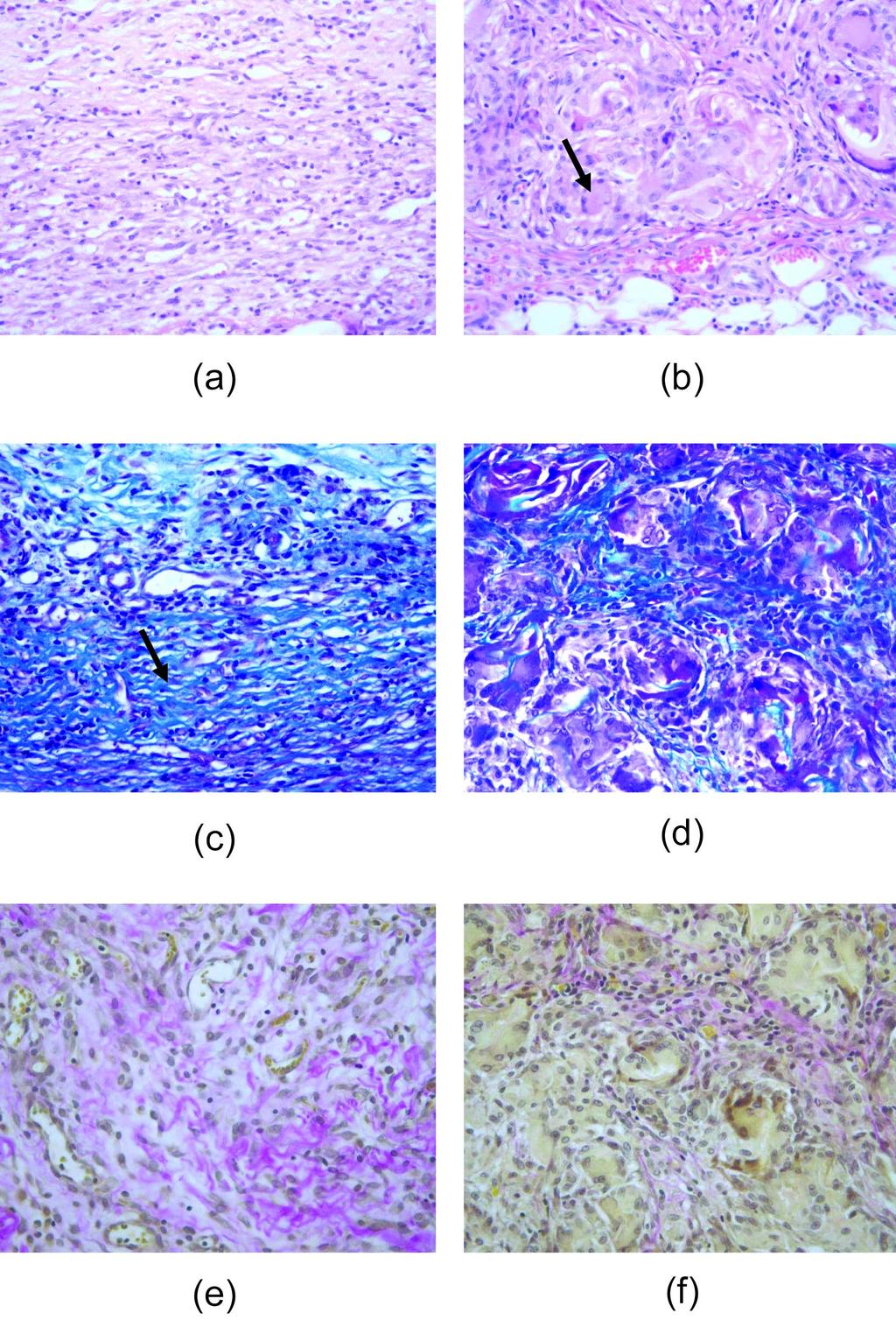 정무상 이영무 216 Histlgical crsssectins f βchitin (a, c, and e) and αchitsan (b, d, and f) scafflds after 7 days.