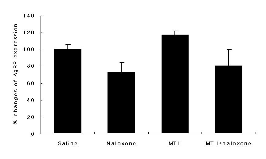 대한내분비학회지 : 제 23 권제 1 호 2008 체중을감소시키는효과를나타내었으며 (P < 0.05) MTII와날록손의혼합투여시추가적인체중감소를나타내었다 (P < 0.01). 정상대조군에서수술후식이섭취와체중이빠르게회복되는데반하여비만쥐에서는식이섭취의회복이느리고체중은계속감소하는양상을나타내었다. 이결과는비만쥐에서수술후회복이지연됨에따른현상으로사료되었다.