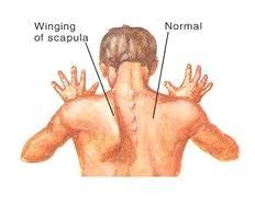 Anatomical Description Round Shoulder Syndrome이요즘현대인들에게흔하게나타나는이유는무엇일까? 여러가지근거들중에서특히 Smart mobile equipment 사용, 일상또는직장생활속흐트러진자세에서의장시간의업무등을대표적인예로들수있다.