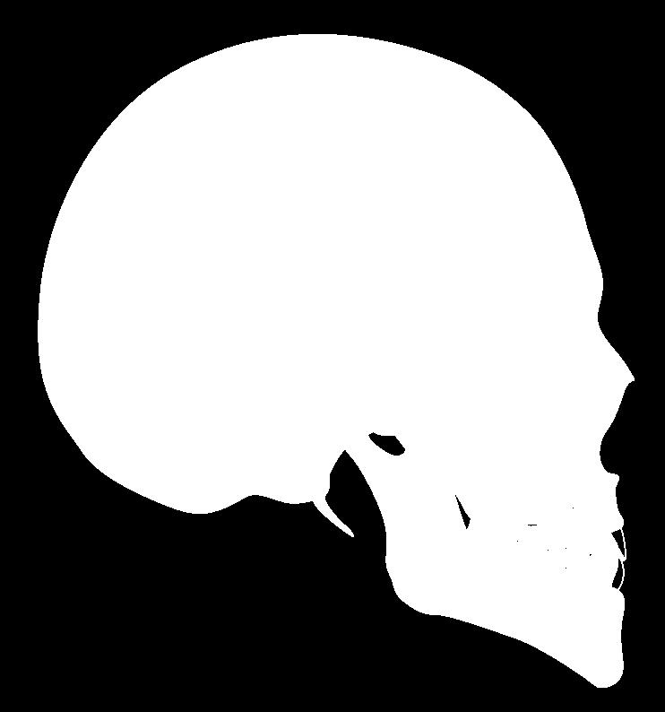 VAULT)) 머리뼈바닥 (cranial