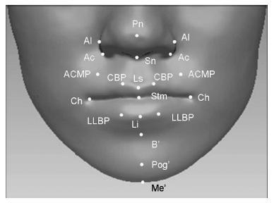 선의중앙점 (the median point of the oral slit when the mouth is closed) - Cheilion (Ch) [Right]: 구각부 (the angle (corner) of the mouth) - Cheilion (Ch) [Left] - Soft tissue B point (B ): 하순과턱사이에서가장깊은부분