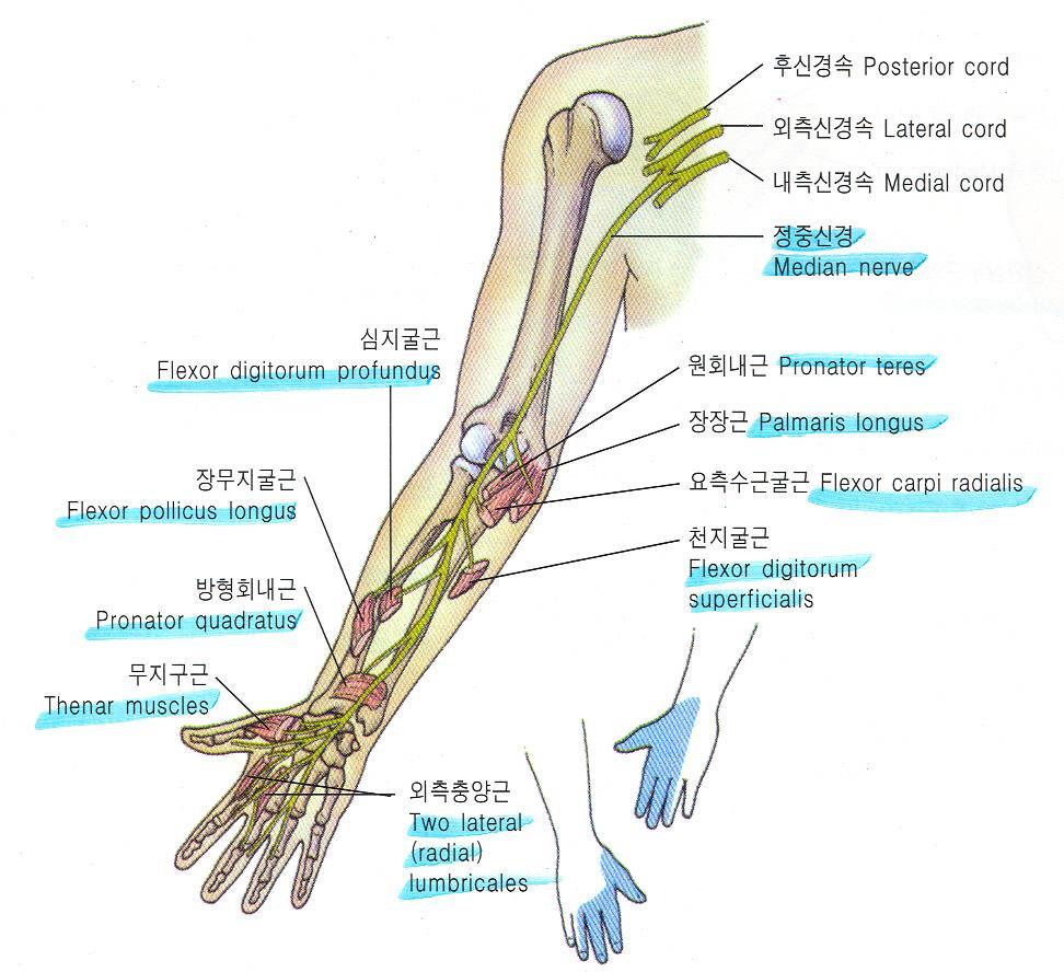 - Colles fracture - Carpal tunnel syndrome (Phalen test) 치료 -