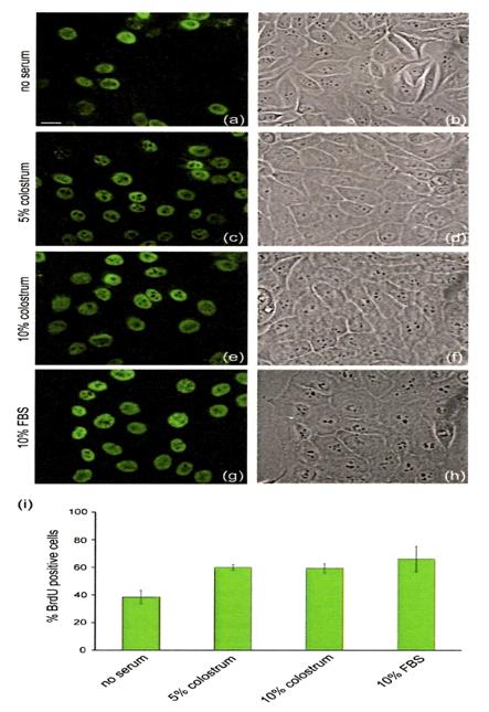 4 Journal of Milk Science & Biotechnology 제 34 권제 1 호 (2016) Fig. 4. Scratch assay on HaCaT cells in response to treatment with colostrum and 10% FBS (Kovacs et al., 2009).. 10% FBS (Fig.