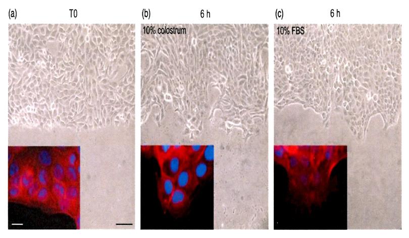 BrdU incorporation assay (a, c, e, g) and parallel phase contrast microscopy (b, d, f, g) of HaCaT cells grown for 24 h in serum-free condition (a, b), in the presence of 5% (c, d), and 10%