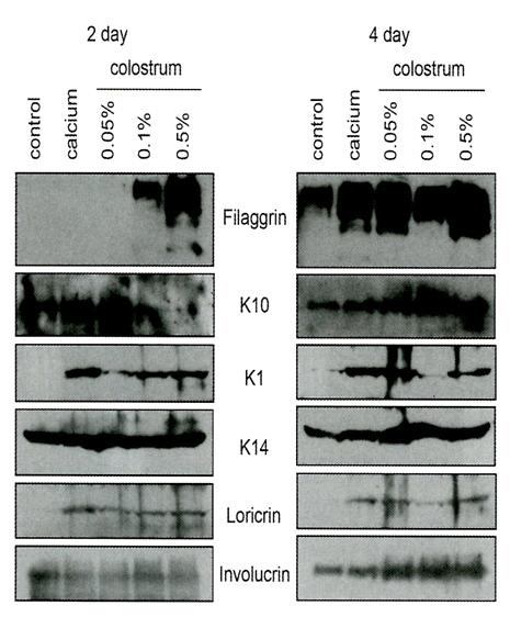 2) In vivo, wound healing of rabbit ear model Fig. 5, Western blot. filaggrin loricrin. K1, K10, involucrin.,.. (a, b) 5%(59.8±2%) 10%(59.2±3.4%) (c, d, e, f) 10% FBS (66±9.2%). (Hironaka et al.