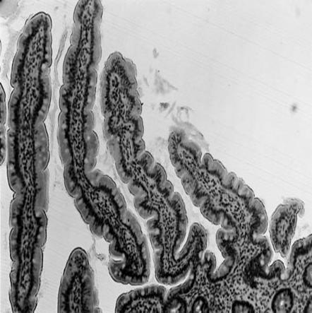 또한 ERK1/2 및 p38과 같은 mitogen activated protein kinase (MAPK)의 활 성화가 각질형성세포 분화에 중요한 역할을 하는 것으로 알 려졌다(Eckert et al., 2002; Efimova et al., 2003). Fig.