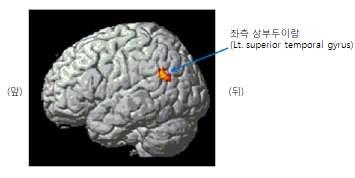 The Journal of Oriental Obstetrics & Gynecology Vol.24 No.1 February 2011 5. 염전자극과 교(S2-Sham) 시뇌활성영역 위침자극비 염전자극과위침자극비 교에의한뇌의활성영역은좌측상측두 이랑(Lt.