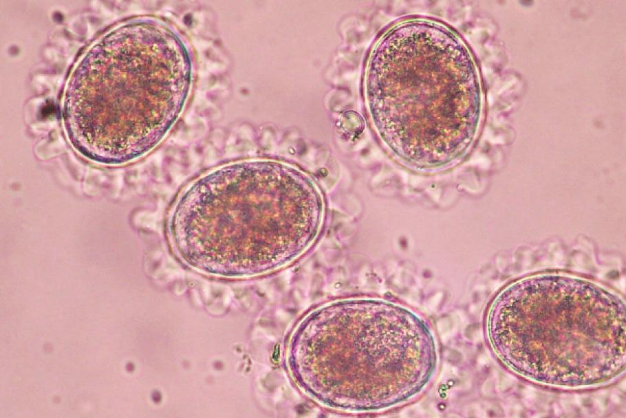 84 Korean J Parasitol Vol. 50, No. 1: 83-87, March 2012 caris eggs originated from animals (http://article.joinsmsn. com/news/article/article.asp?ctg =12&Total_ID =1715222).