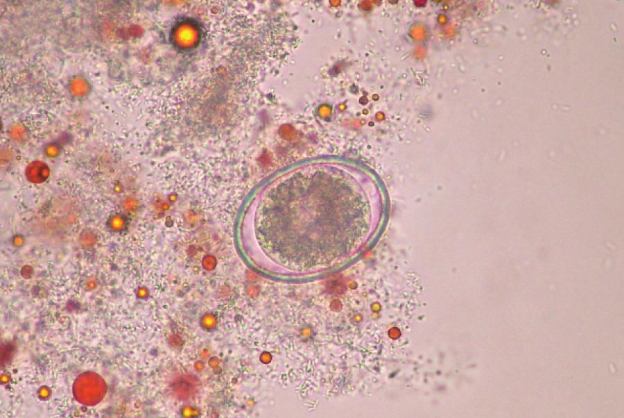 lumbricoides [9-11] and Giardia lamblia [12], and the presence of index microorganism [13]. However, no study has been conducted on the survival of A. suum eggs in kimchi at different temperatures.