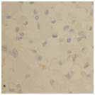 immunostain (Solution B) (1) Conventional (1% BSA, 0.