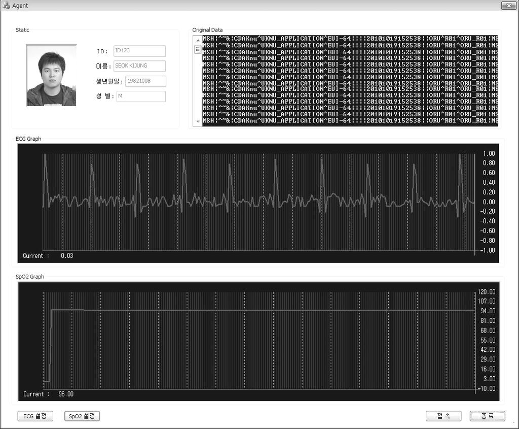 논문 /M2M 을위한 U- 헬스케어응용서비스기반 IEEE 11073/HL7 변환게이트웨이설계및구현 그림 10. IEEE 11073/HL7 프로토콜변환게이트웨이에서 HL7 Application 으로부터건강관리서버를통해전송받은요청메시지 그림 11.