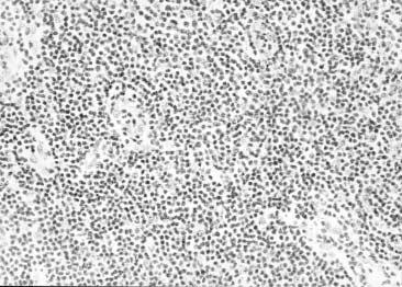 negative 5 68 F oral cavity positive methyl 6 42 F eyelid positive methyl 7 20 M skin negative 8 49 F skin negative 9 42 F colon positive methyl 10 71 M nasal cavity, soft tissue negative 11 36 M