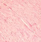 (2) 심장 심장은좌심실의가로로배열된심근세포들을중심으로관찰한결과, 대조군에서윤반을단위로세포질에강한호산성염색소견인 eosinophilic band (E.P) 가특징적으로나타났다. 반면 HDE 투여군에서는세포질이호산성으로염색되는심근세포의수가현저하게줄어들었다 (Fig. 24). E.