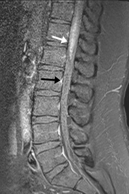 넙다리신경 (Femoral nerve) 은척수에서나온두번째세번째그리고네번째허리신경으로구성되고, 좌골신경 (sciatic nerve) 은네번째다섯번째허리신경과첫번째두번째그리고세번째엉치신경으로구성된다.