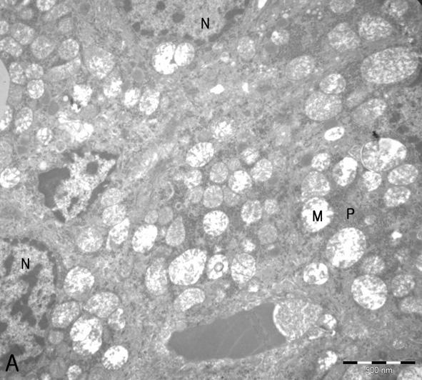 대한한의학 방제학회지 제22권 제1호 (2014년 6월) Herbal Formula Science(HFS) 2014;22(1):177~192 Figure 16. Electron micrographs of hepatocytes from the CAA group. Figure 15.