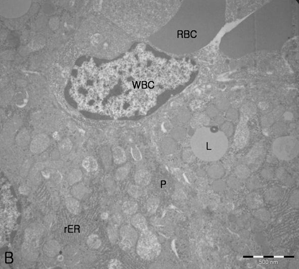 A white blood cell(wbc) and red blood cell(rbc) are observed in the sinusoid. L, lipid droplet; N, nucleus; P, polysome. Bar indicate 500 nm.