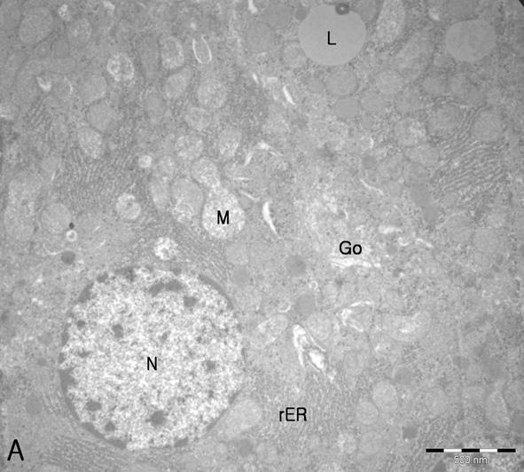 KC, Kupffer cell; L, lipid droplet; M, mitochondria; N, nucelus. RBC, red blood cell. Bar indicate 500 nm. 대조군 간세포의 미세구조를 관찰한 결과 핵의 자밀도는 대체로 높게 나타났다(Fig. 16A).