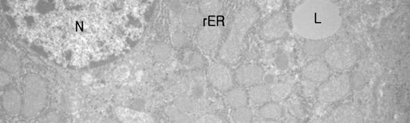 Electron micrograph of hepatocytes from the CAB group. A. The rough endnoplasmic reticulum(rer) are well developed, Arrows indicate lysosomes.