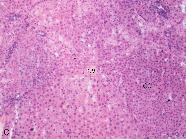 extract 400 / /day administered group during 9 weeks after DENA and CCl4 treatment. All values are mean ± S.E. (n=6) Figure 14.