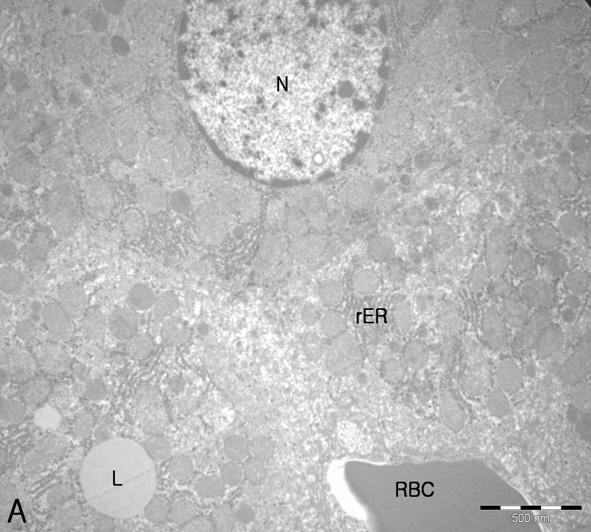 CAA군에서는 대조군과 유사하게 조직 전반에 Figure 13. Histological sections of liver of rats in response to CLR extracts in the DENA and CCl4-induced liver injury.