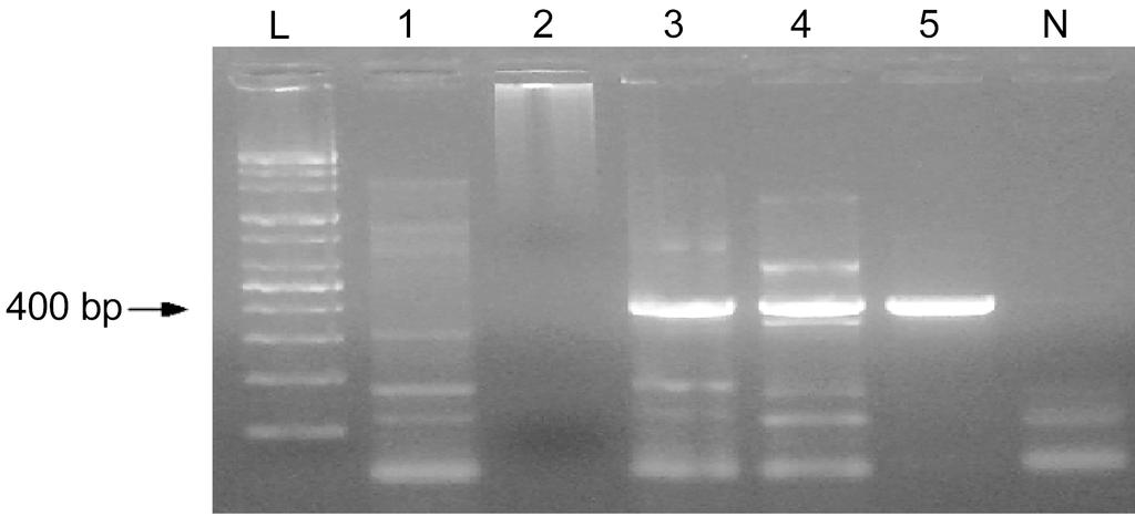 182 Young-Jin Ko and Hong-Bum Cho Kor. J. Microbiol primary PCR ƒ û š, nested PCR primary PCR w 2. Fig. 1. Results of agarose gel electrophoresis of amplified genomic DNA of R.