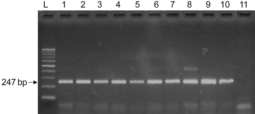 Lane 1, genomic DNA extracted by SDS lysis method; 2, STET method; 3, boiling with chelex X-100 resin method; 4, DNAzol method; 5, DNAzol treatment and boiling with chelex X-100 resin; L, ladder; N,