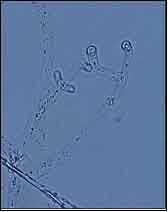 niger Tieghem 분생포자경및분생포자 (400x) < 왼쪽 >, 스케치 < 오른쪽 >