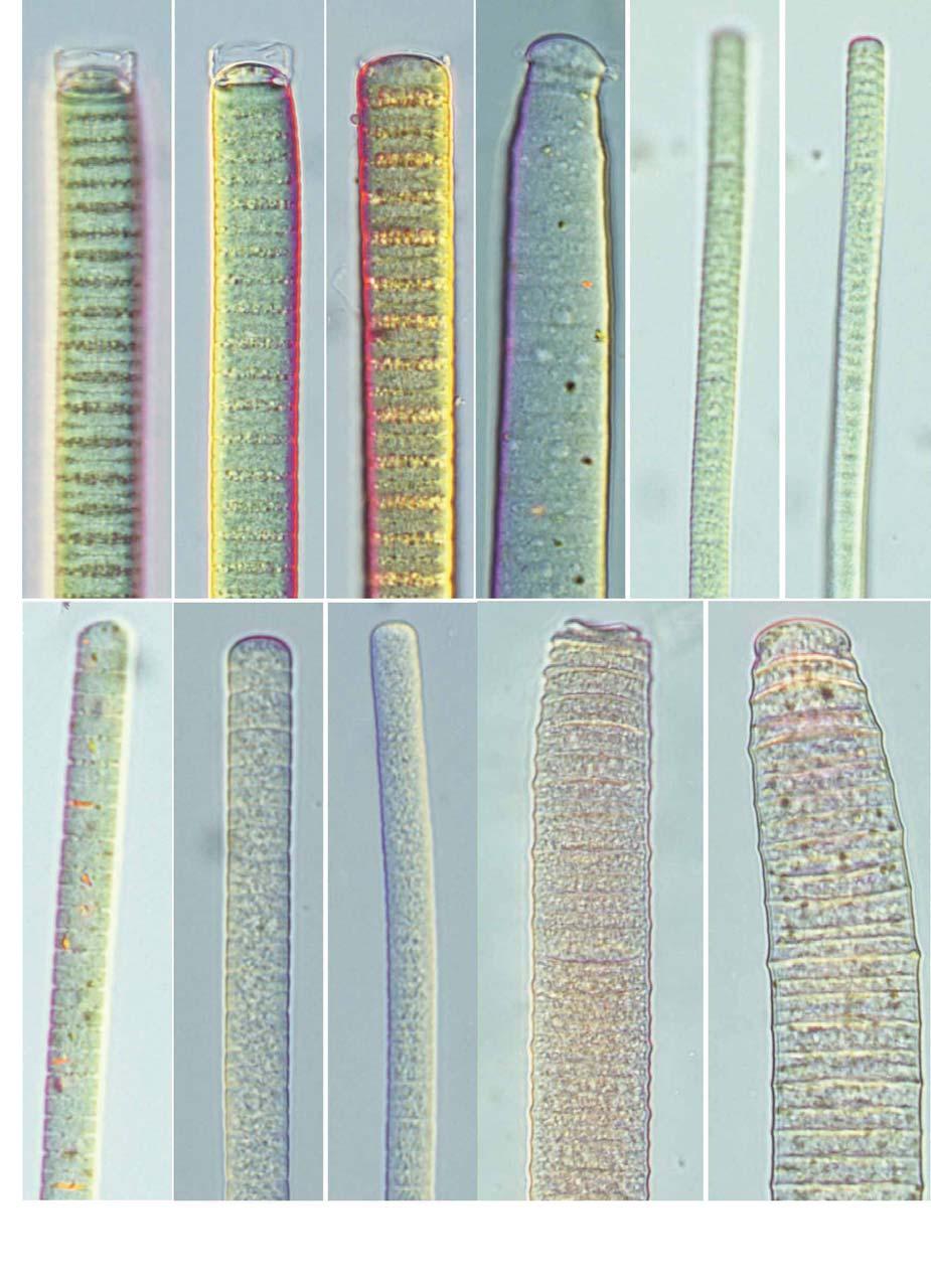 : : 69 A B C D E F G H I J K 50 μm 50 μm 21. A C. Oscillatoria limosa; D.