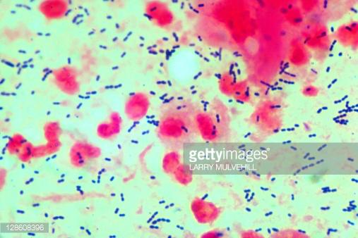 Streptococcus pneumoniae 폐렴사슬알균 1.