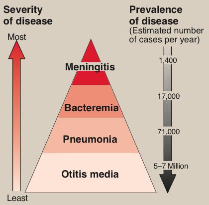 Meningitis ( 수막염 ) - S. pneumoniae는균혈증, 중이염또는머리외상을통해서중추신경계로전파될수있음. - 신생아에게는드물지만어린아이와어른에서수막염의주요원인 - S.